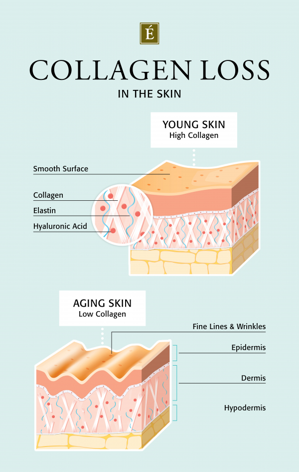Collagen loss in the skin infographic