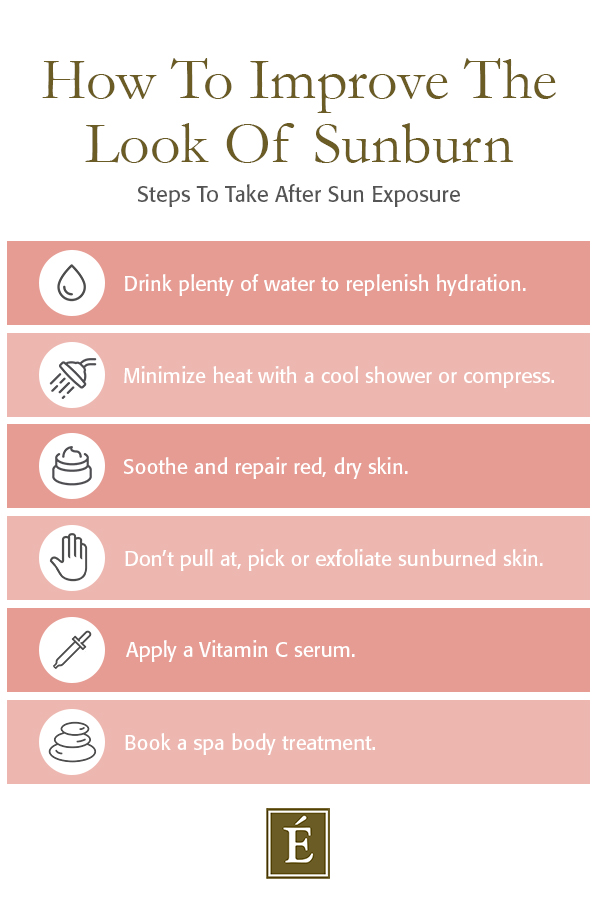 How to improve the look of sunburn infographic