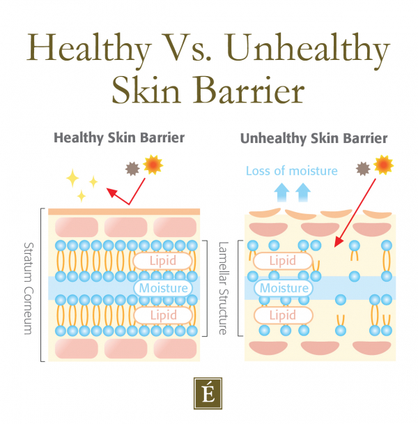Healthy vs unhealthy skin barrier graphic
