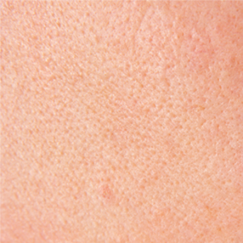 A close-up of skin pores. 