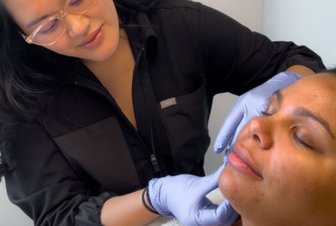 A Look at Dermal Fillers for Reducing Scar Tissue